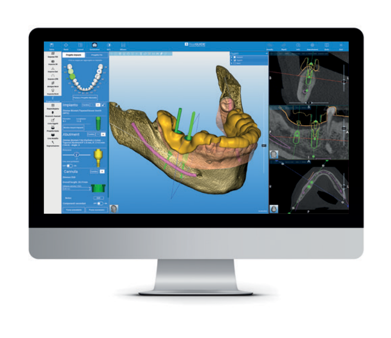desktop computer screen displaying the RealGUIDE Software Suite, a comprehensive platform for digital dental implant planning.