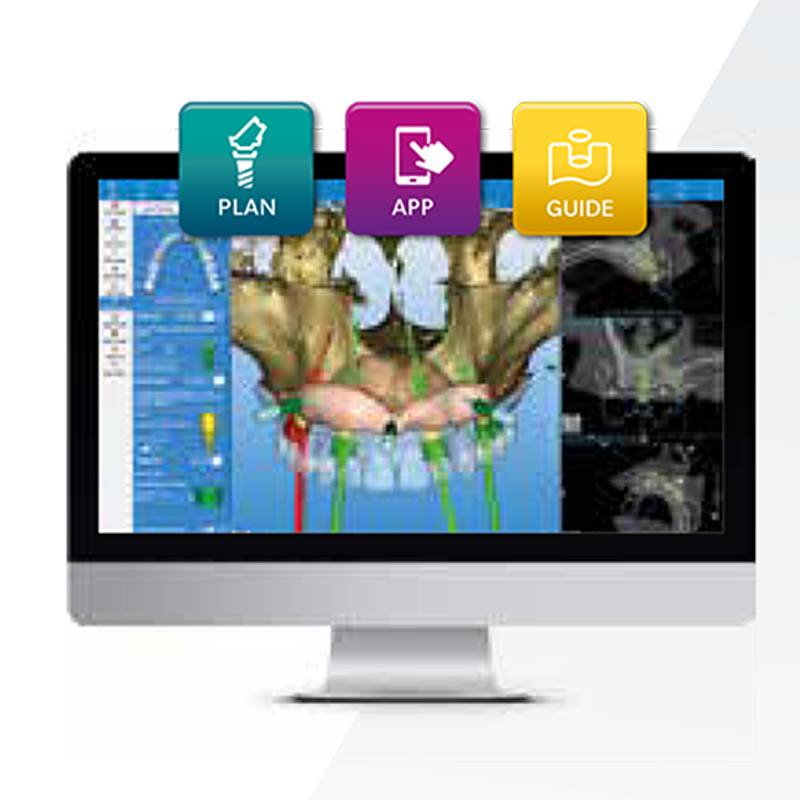 RealGUIDE™ Software suite is recommended for complete top-down design of an aesthetically restored Azure TBL Implant
