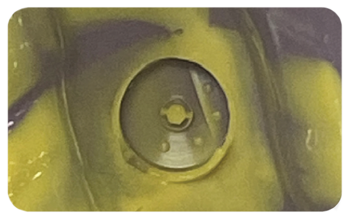 encode emergence impression system traditional pvs impression