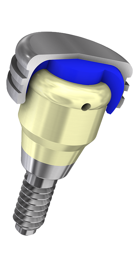 ZimVie OverdenSURE abutment, featuring a light gold Zirconium Nitride (ZrN) coating for enhanced aesthetics, biocompatibility, and reduced bacterial adhesion.